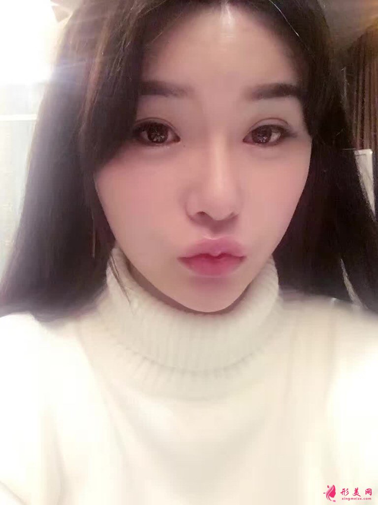 深圳赫思醫(yī)療美容怎么樣？價目表及網(wǎng)紅鼻整形案例