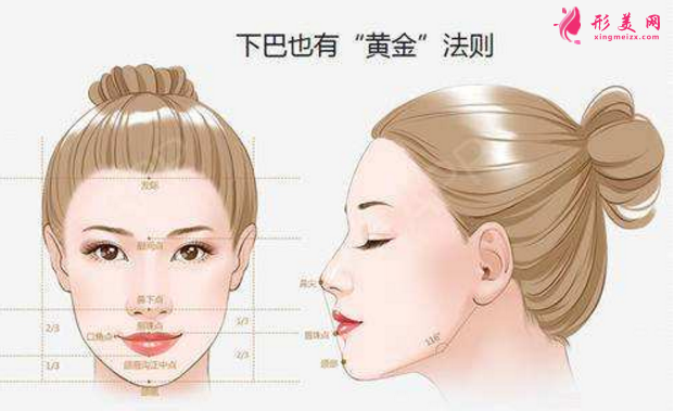 自體脂肪隆下巴效果圖