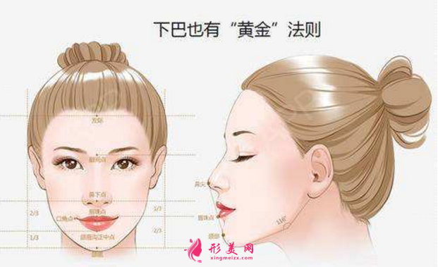 自體脂肪隆下巴效果圖