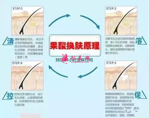 果酸換膚需要多少錢(qián)