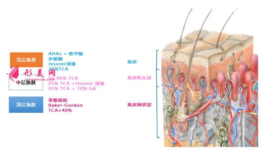 果酸換膚需要多少錢(qián)