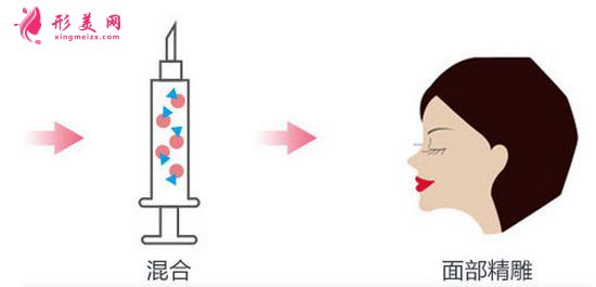 臉部自體脂肪填充價(jià)格