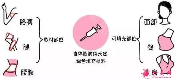 臉部自體脂肪填充價(jià)格