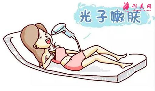 激光除皺手術效果