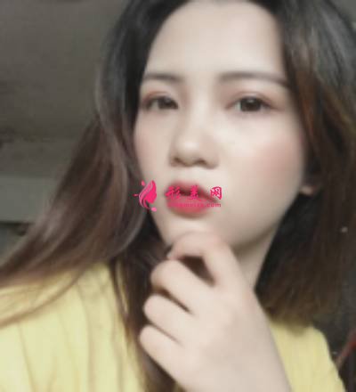 找李曾顯醫(yī)生注射肉毒素去木偶紋手術(shù)后30天