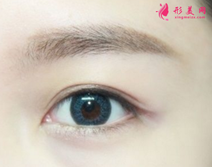 什么不適合做開眼角手術(shù)