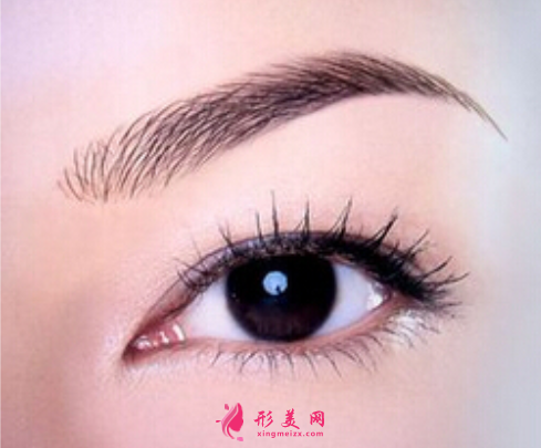 開(kāi)內(nèi)眼角一般會(huì)回縮多少
