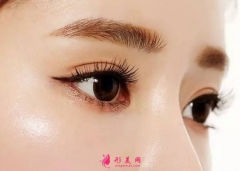 雙眼皮術(shù)后有點(diǎn)寬怎么修復(fù)？