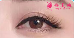 開(kāi)眼角手術(shù)的價(jià)格費(fèi)用要多少