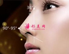 假體隆鼻術(shù)前術(shù)后要注意的事項？