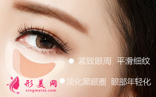 手術(shù)切除眼袋后多久恢復(fù)自然