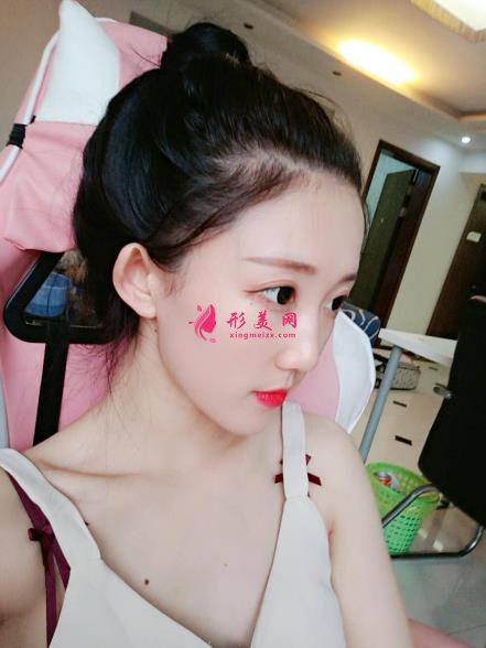 深圳香蜜麗格醫(yī)療美容激光祛斑3個月