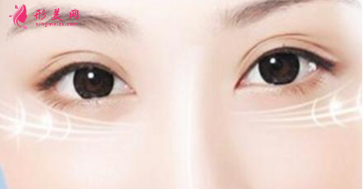 如何快速去除難看的眼袋