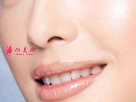 廣州鼻翼縮小的價(jià)格跟什么因素有關(guān)