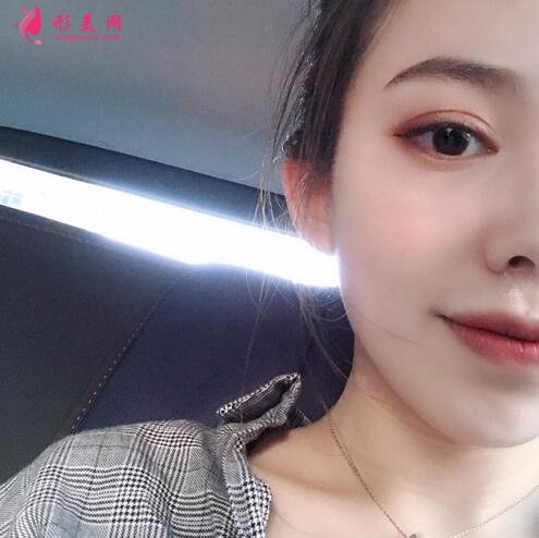 蕪湖瑞麗羅偉祛眼袋