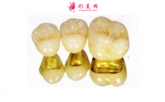 牙齒做瓷貼面好嗎？做完會(huì)不舒服嗎？