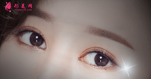 開眼角手術(shù)后多久可以戴隱形眼鏡