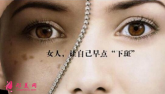 激光祛斑一次有效果嗎?一般會(huì)做幾次？