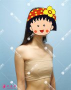 廣州曙光整形美容醫(yī)院妙桃假體隆胸真實案例分享