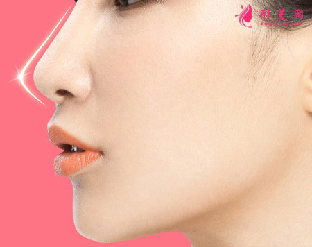 自體軟骨隆鼻恢復(fù)期內(nèi)要注意的護(hù)理事項(xiàng)