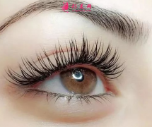 開內(nèi)眼角要多長(zhǎng)時(shí)間？