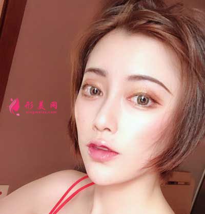 成都軍大整形鼻綜合整形成功案例