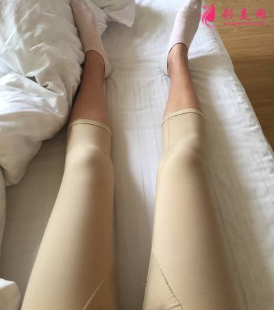 在鄭州悅美整形美容醫(yī)院做的吸脂瘦大腿手術(shù)后