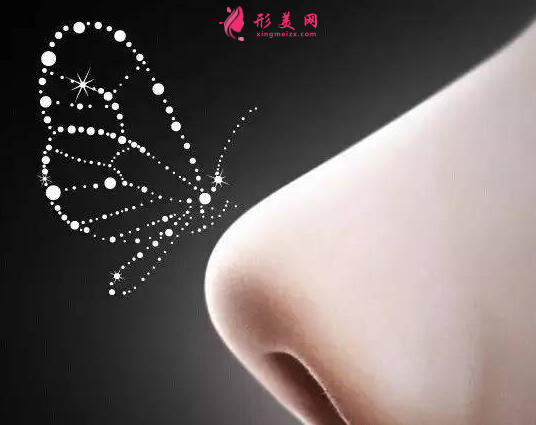 自體軟骨隆鼻的風(fēng)險(xiǎn)