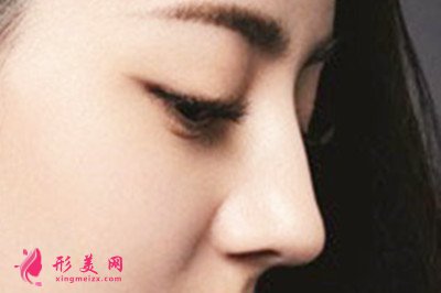 做假體隆鼻會(huì)不會(huì)很痛