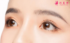 做雙眼皮手術(shù)的大致過(guò)程？