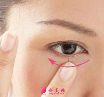 手術(shù)祛除眼袋會(huì)不會(huì)失敗