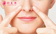 如何讓鼻翼縮小變高挺？