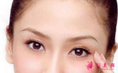 激光去黑眼圈的效果是長(zhǎng)久的嗎?