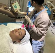 和顏美帕劉喆做白瓷娃娃怎么樣？術后60天真人案例效果分享~