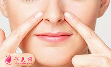 做鼻翼縮小的效果如何