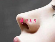 上海整形醫(yī)院假體隆鼻專家怎樣選擇？有沒有推薦的？