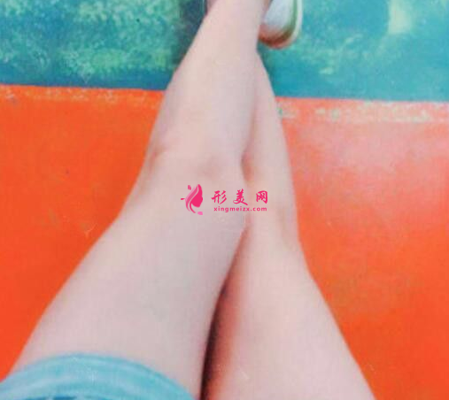 找上海玫瑰鄒功偉做的大腿吸脂 術(shù)后85天效果對比真的非常不錯