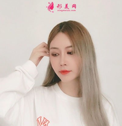 成都菲格隆鼻手術案例