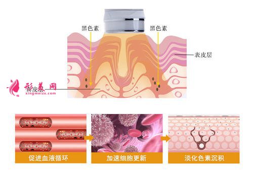 【美麗加分】面部光子嫩膚能帶來哪些效果？