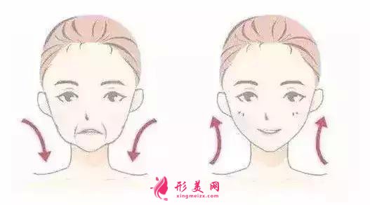 打玻尿酸要多少錢
