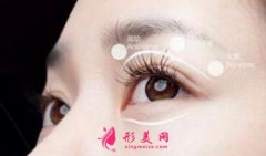 雙眼皮手術(shù)過程痛苦嗎？