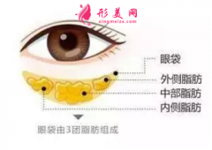 祛眼袋手術(shù)要忌口多久？