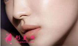 隆鼻假體以后會變形嗎
