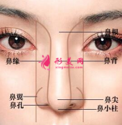 隆鼻假體以后會(huì)變形嗎？
