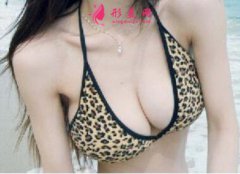 假體隆胸的價位是多少？