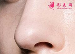 上海整形醫(yī)院假體隆鼻手術要多少錢？