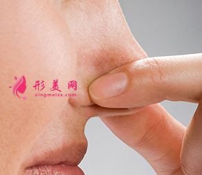 鼻翼縮小手術(shù)的方法有哪些