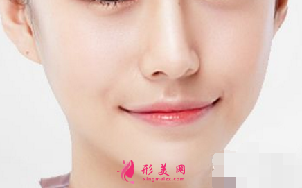 鼻翼縮小手術(shù)的方法有哪些