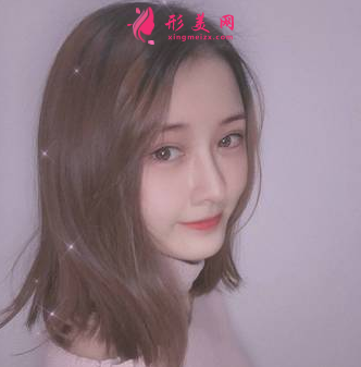 找成都成美整形醫(yī)院王立鵬做的自體軟骨隆鼻,價格_案例分享