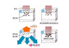術(shù)前科普：激光祛斑多少錢一次？